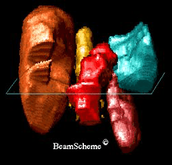 3D computer image .