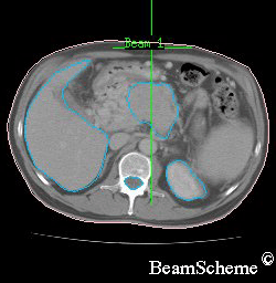 CT scan cross section .