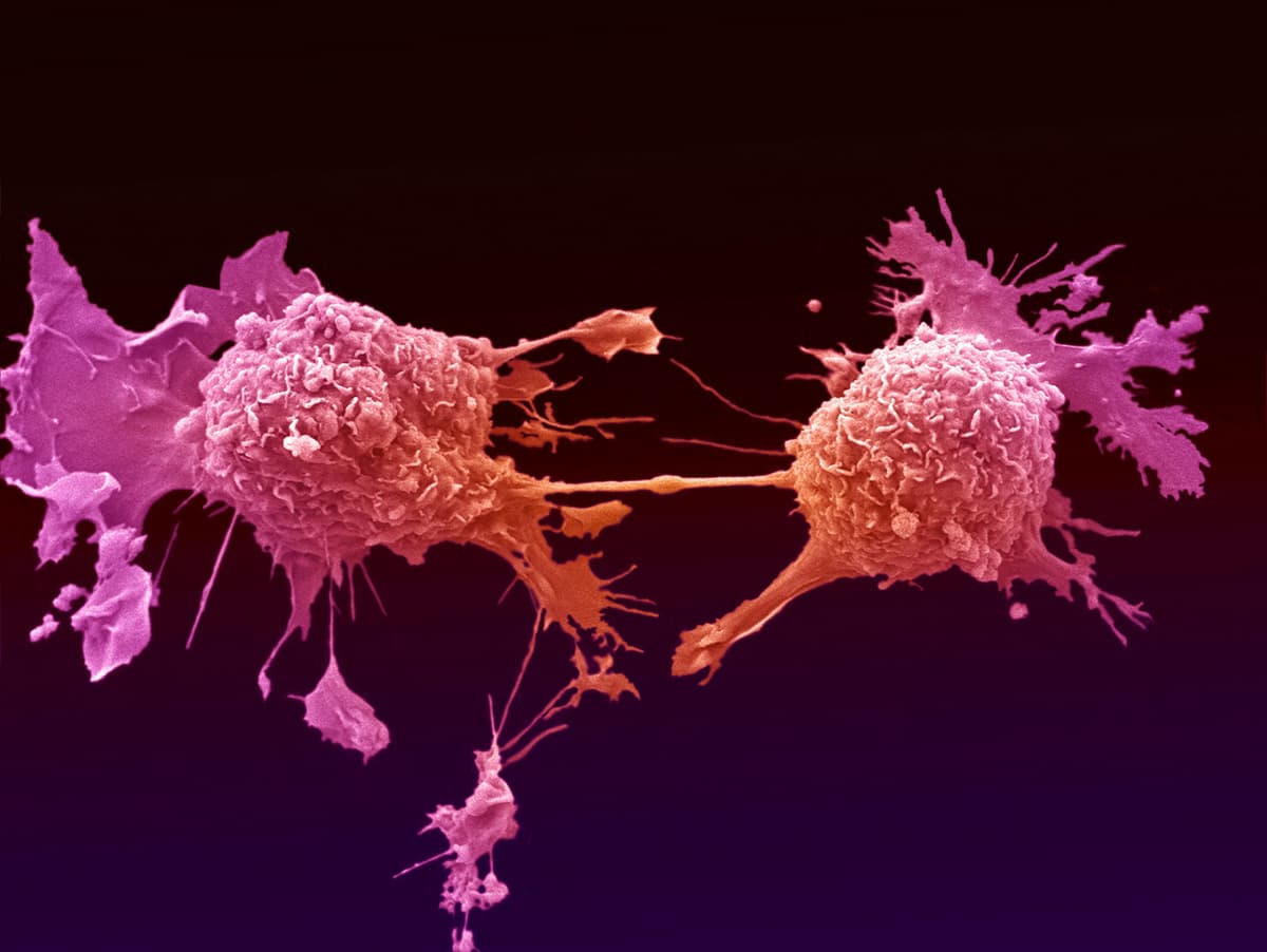 Image of microscopic lung cancer cells from the Francis Crick Institute.