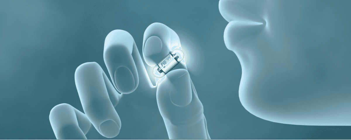Illustration of a patient taking a pill cam.