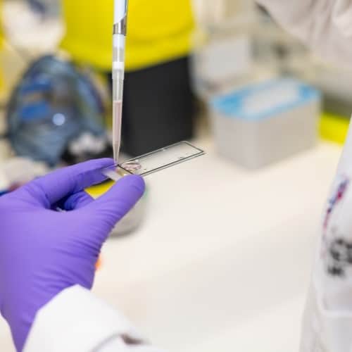 A close up of a dropping sample on a microscope slide.