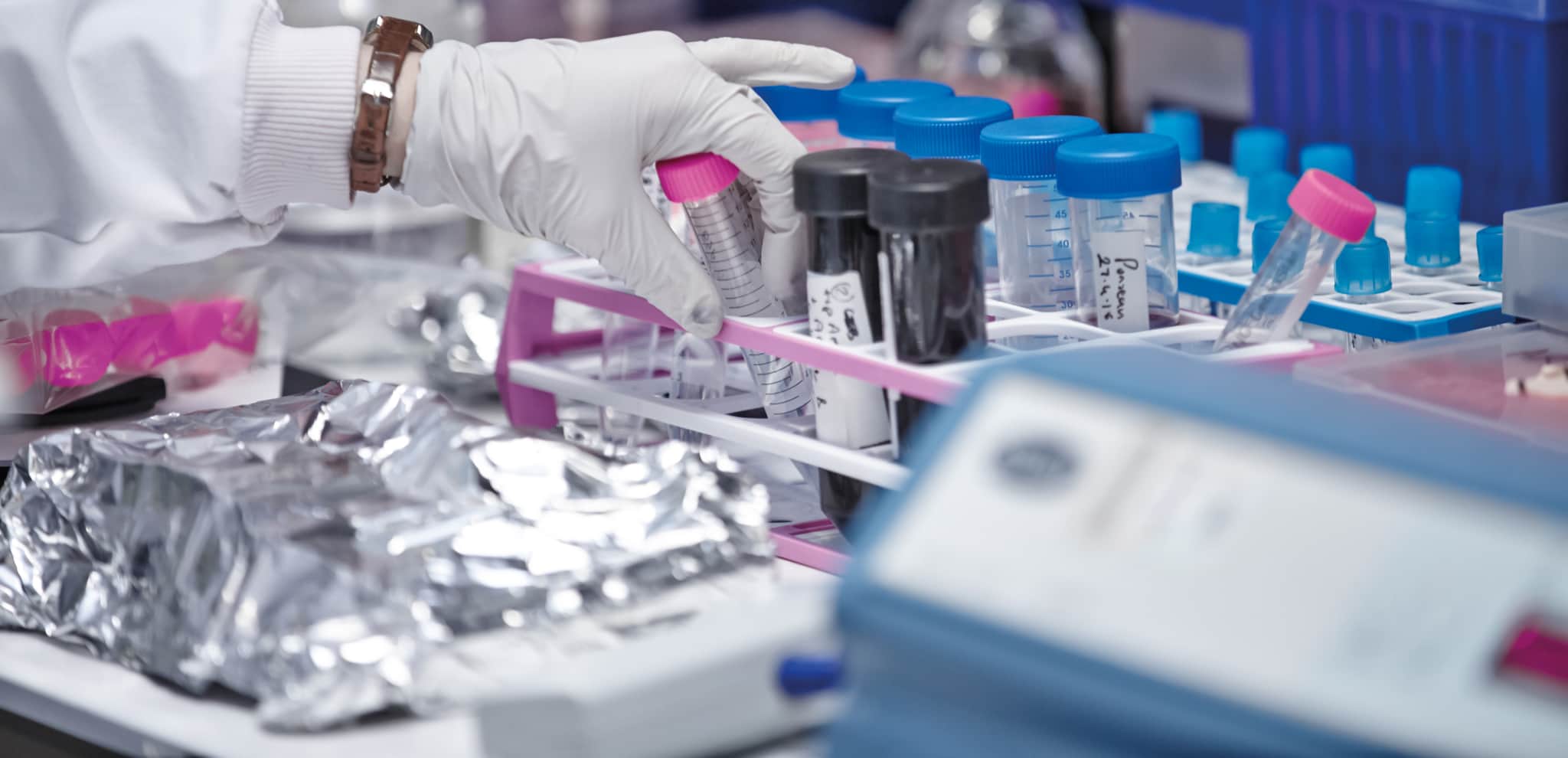 A researcher taking a test tube from one of the racks of test tubes at Oxford Institute for Radiation Oncology.