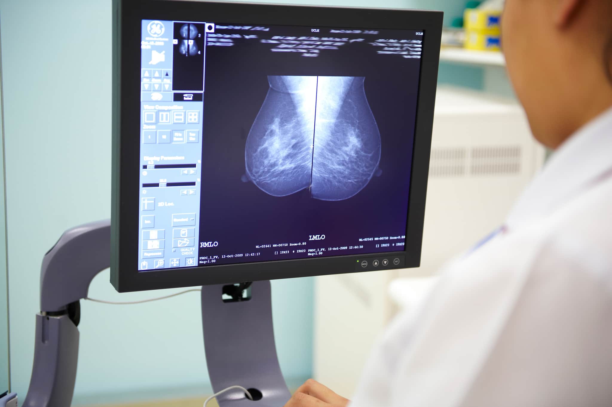 A radiographer examining a mammogram image.